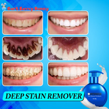 INTENSIVE STAIN REMOVAL TOOTHPASTE