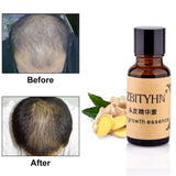 Fast Hair Growth Essence Oil Hair Growth for Men and Women 20ml