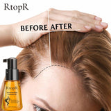 Moroccan Hair Loss Prevent & Hair Growth Oil