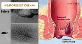 Hemorelief Cream